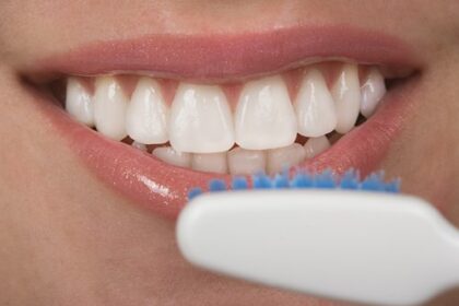 Caring for Teeth After Getting Veneers