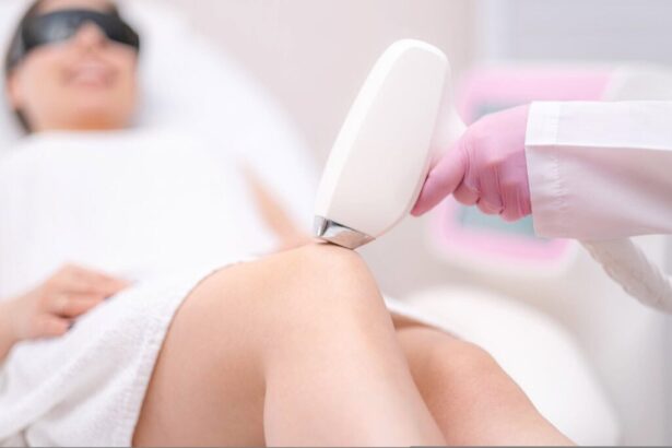 Laser Hair Removal