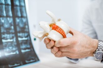 Treatment Options for a Herniated Disc