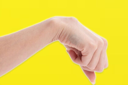 Treatment for Sarcoma